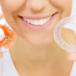 Aparat Invisalign Warszawa