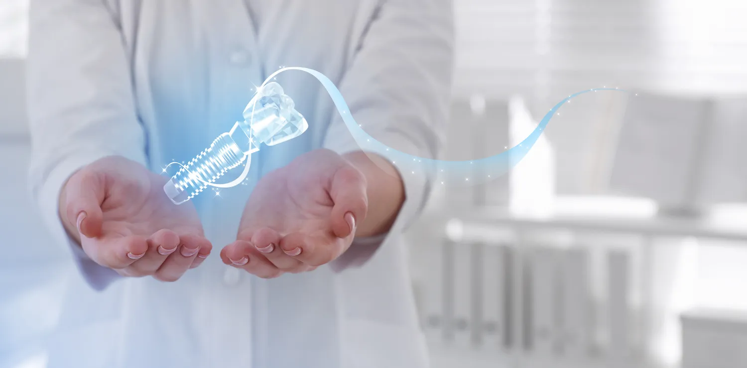 gdzie-zrobic-implanty-zebow-1