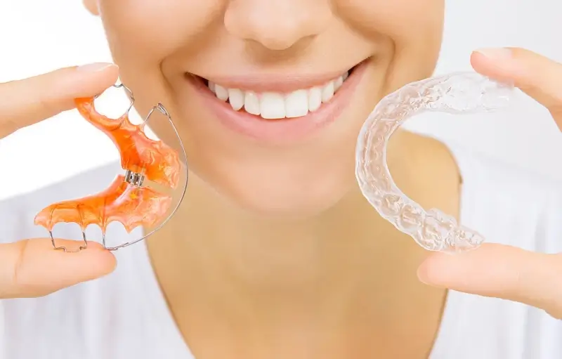 co-to-jest-invisalign-1