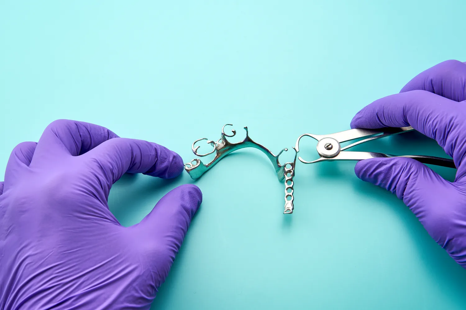 wszystko-co-musisz-wiedziec-o-implantach-zebowych-1