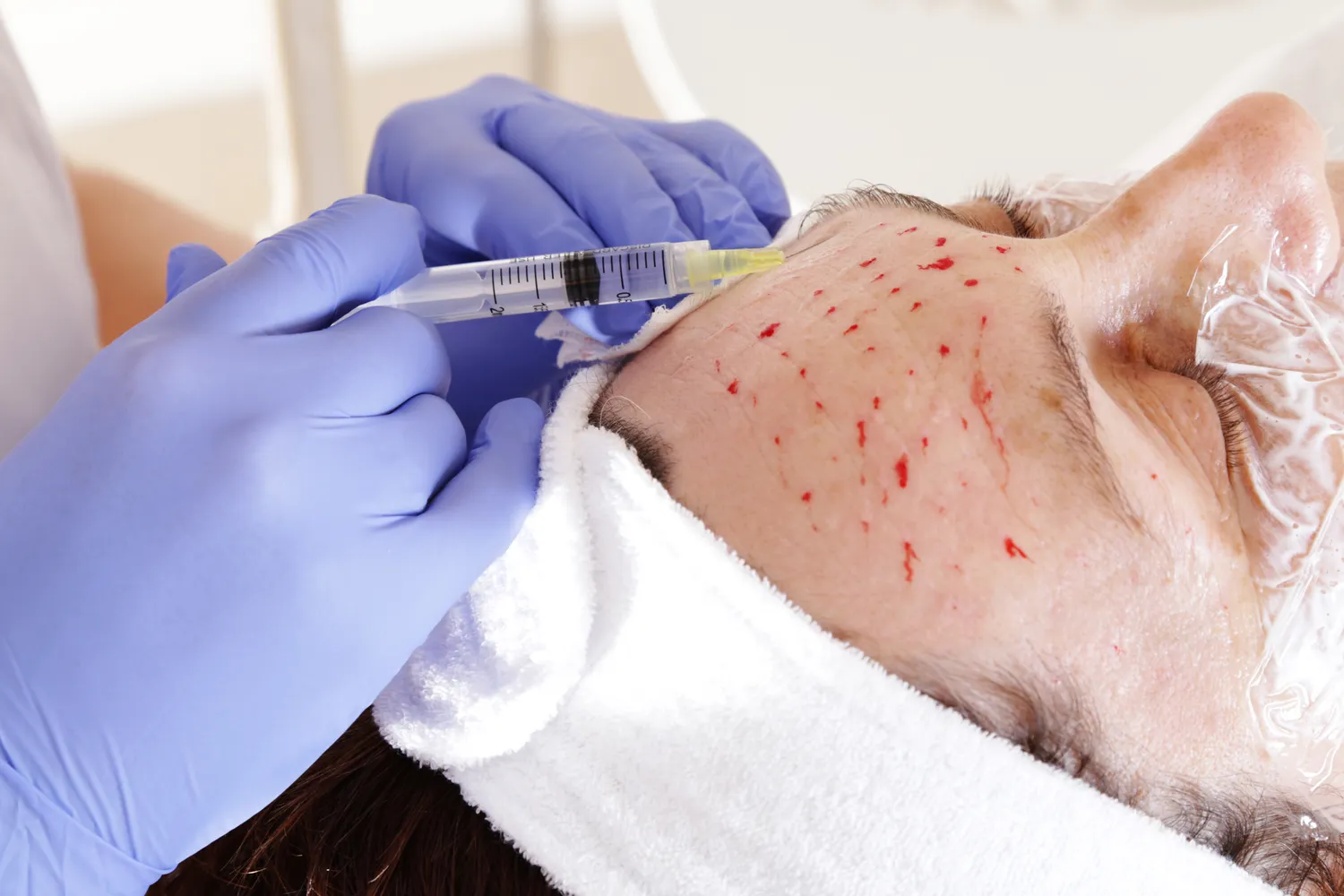 medycyna-estetyczna-kto-moze-wykonywac-zabiegi-1