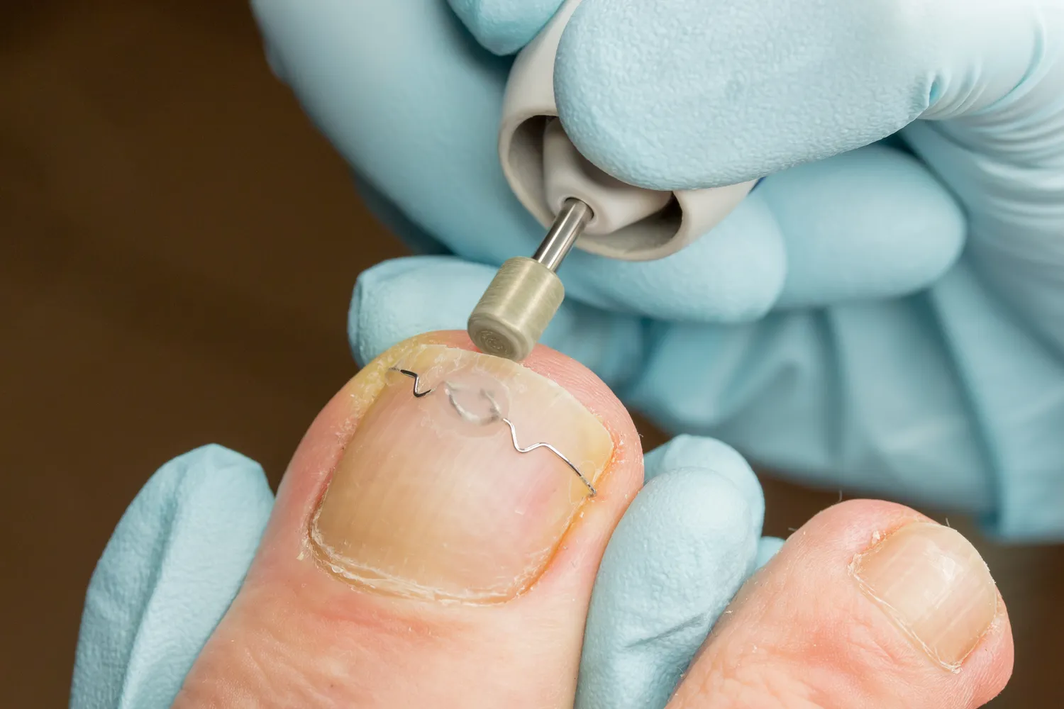 Czym zajmuje się specjalista od stóp?