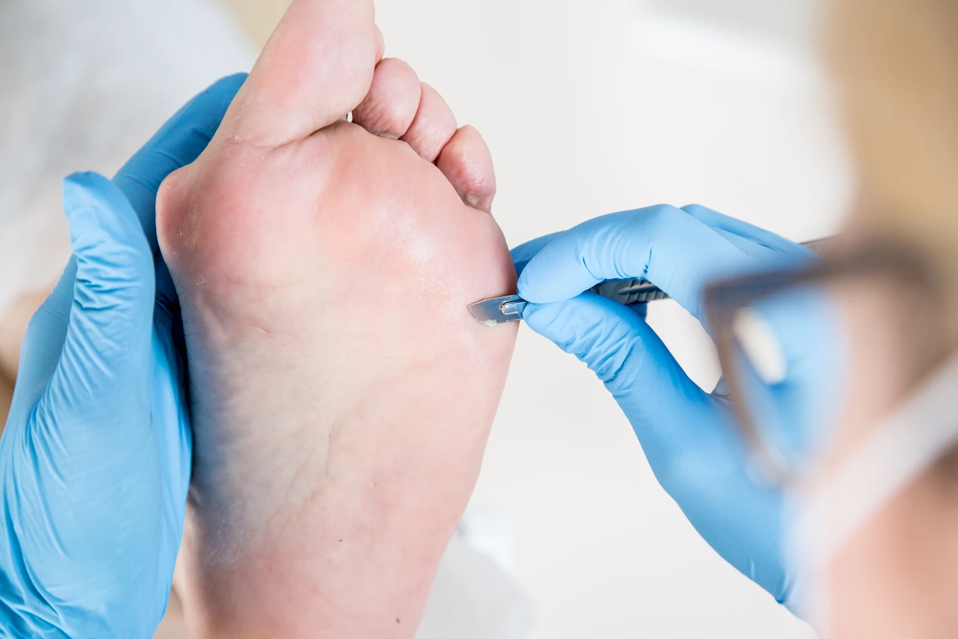 Jak wygląda podstawowy zabieg podologiczny?