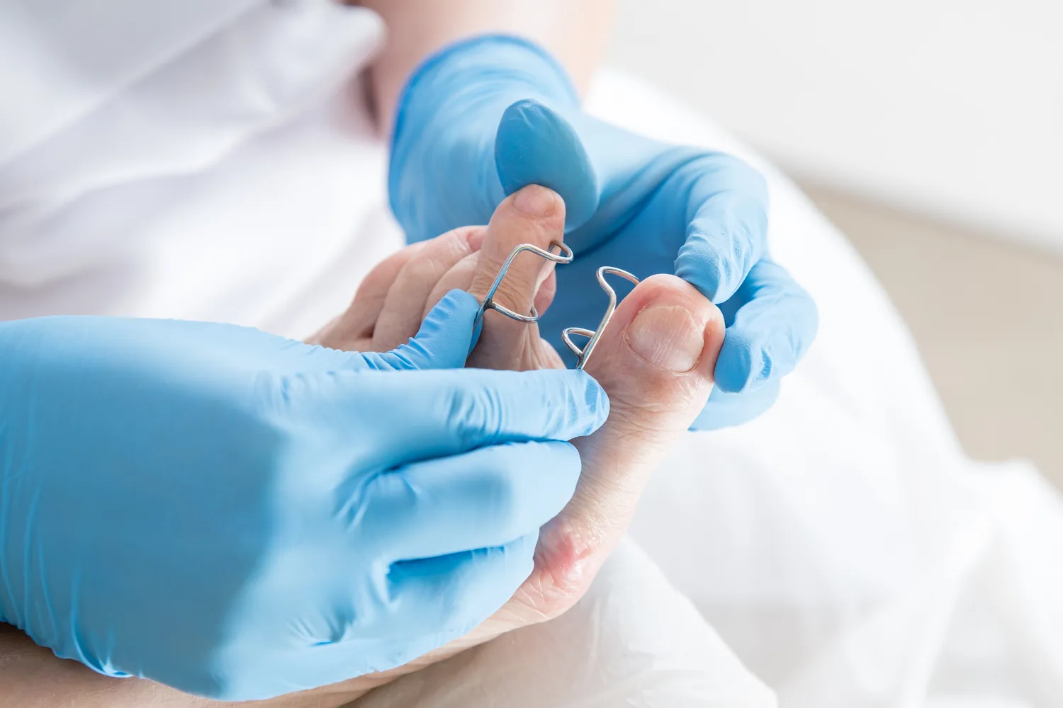 Swędzące stopy - problem podologiczny