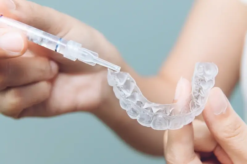 aparat-nakladkowy-invisalign-1